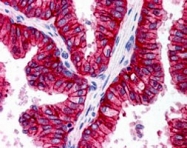 PAB6698 - ABCC4 / MRP4