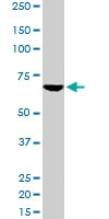 PAB6707 - TOM1L2