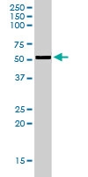 PAB6709 - AKT3 / PKB gamma