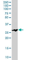 PAB6716 - Mannan Binding Protein