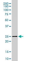PAB6717 - Synaptogyrin-2 / SYNGR2