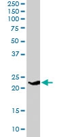 PAB6719 - Synaptogyrin-4 / SYNGR4