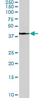 PAB6725 - Alcohol dehydrogenase 1A / ADH1