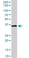 PAB6737 - AKR1C3 / DDH3