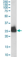 PAB6740 - Triosephosphate isomerase (TPI1)