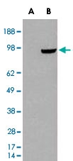 PAB6741 - PDE5A