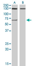 PAB6747 - Acetylcholinesterase