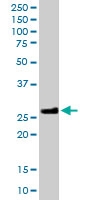 PAB6753 - MOG