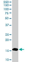 PAB6754 - Retinol-binding protein 1