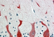 PAB6755 - RAR-alpha / RARA