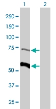 PAB6761 - PCSK9