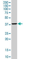 PAB6762 - Nucleophosmin