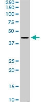 PAB6764 - SERPINI2
