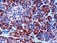PAB6764 - SERPINI2