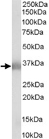 PAB6765 - Apolipoprotein E / Apo E