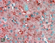 PAB6765 - Apolipoprotein E / Apo E