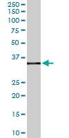 PAB6767 - CD32B