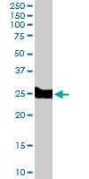PAB6770 - BID