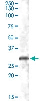 PAB6771 - CHMP5