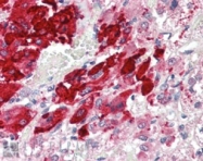 PAB6777 - POMC