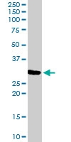 PAB6781 - Cathepsin F