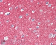 PAB6782 - SNAP25