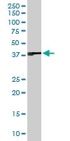 PAB6786 - Renalase