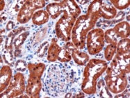 PAB6786 - Renalase