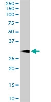 PAB6790 - CD279 / PD1