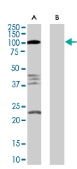 PAB6793 - Nogo 66 receptor