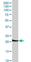 PAB6795 - Lipocalin-2