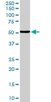 PAB6799 - NPY Receptor 5 / NPY5R