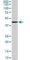 PAB6809 - Vitamin D3 receptor / NR1I1