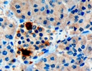 PAB6810 - Pancreatic prohormone