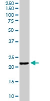 PAB6817 - Glutathione peroxidase 2 / GPX2