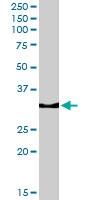 PAB6818 - Osteopontin / SPP1