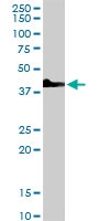 PAB6827 - RAE1
