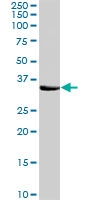 PAB6845 - Syntaxin 1A / 1B (STX1A / STX1B)