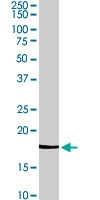 PAB6848 - Cofilin-2