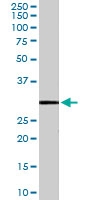 PAB6849 - MMP-7