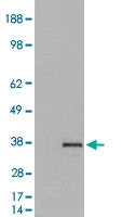 PAB6858 - GDF15