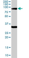 PAB6864 - LDB3
