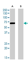 PAB6867 - Amine Oxidase A / MAOA