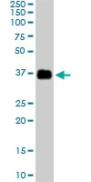 PAB6868 - Apolipoprotein J / Apo J