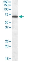 PAB6876 - Cannabinoid receptor 1