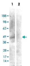 PAB6876 - Cannabinoid receptor 1
