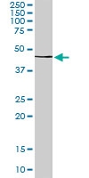 PAB6877 - Cannabinoid receptor 2