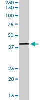 PAB6882 - PCID1 / EIF3M