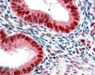 PAB6883 - CBX5