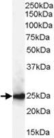 PAB6884 - CBX1
